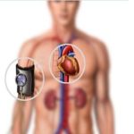 علاج ضغط الدم المنخفض وهل انخفاض ضغط الدم خطير ؟